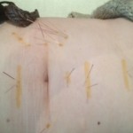 abdominal acupuncture, the palms centre, gorey